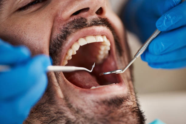 Best Emergency Tooth Extraction in Sterling, IL